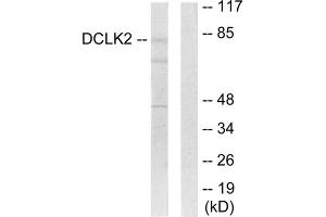Western blot analysis of extracts from HepG2 cells, using DCLK2 antibody. (DCLK2 anticorps  (N-Term))
