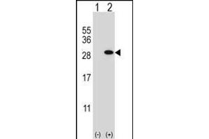 Western blot analysis of GSTT1 (arrow) using rabbit polyclonal GSTT1 Antibody (N-term) (ABIN656825 and ABIN2846035). (GSTT1 anticorps  (N-Term))