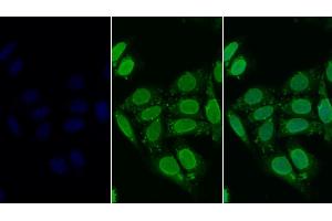 Detection of HDAC6 in Human HepG2 cell using Polyclonal Antibody to Histone Deacetylase 6 (HDAC6) (HDAC6 anticorps  (AA 560-811))