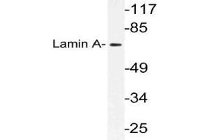 Western blot (WB) analysis of Lamin A antibody in extracts from HeLa cells. (Lamin A/C anticorps)