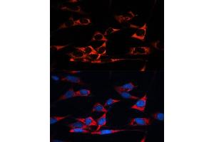 Immunofluorescence analysis of NIH/3T3 cells using MB antibody (ABIN1680748, ABIN3017668, ABIN3017669 and ABIN6220205) at dilution of 1:100.