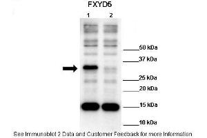 Lanes:   Lane 1: 10ug hFXYD5 transfected 293T lysate Lane 2: 10ug 293T lysate  Primary Antibody Dilution:    1:1000  Secondary Antibody:   Anti-rabbit HRP  Secondary Antibody Dilution:    1:4000  Gene Name:   FXYD5  Submitted by:   Anonymous (FXYD5 anticorps  (N-Term))