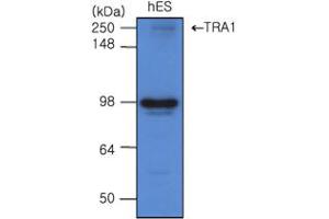 Western blot analysis: The cell lysates of hES(20ug) were resolved by SDS-PAGE, transferred to PVDF membrane and probed with antihuman TRA 1 (1:500). (GRP94 anticorps)
