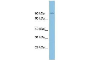 TLK1 antibody used at 1 ug/ml to detect target protein.