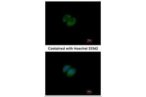 ICC/IF Image Immunofluorescence analysis of methanol-fixed A549, using HPRT, antibody at 1:500 dilution. (HPRT1 anticorps)