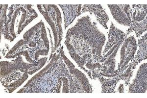 IHC analysis of HDAC5 using anti-HDAC5 antibody (ABIN7599922). (HDAC5 anticorps  (AA 13-1107))