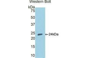 Western Blotting (WB) image for anti-Peroxisome Proliferator-Activated Receptor gamma (PPARG) (AA 280-475) antibody (ABIN2118515) (PPARG anticorps  (AA 280-475))