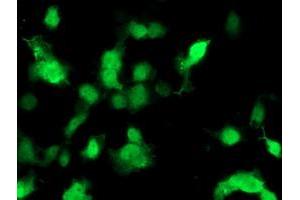 Image no. 2 for anti-Phosphomevalonate Kinase (PMVK) antibody (ABIN1500302)