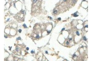 Immunohistochemical analysis of paraffin-embedded human fetal liver showing cytoplasmic staining with ABCF3 polyclonal antibody  at a 1 : 100 dilution. (ABCF3 anticorps  (AA 442-681))