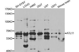 Western blot analysis of extracts of various cell lines, using ATL1 antibody (ABIN5973048) at 1/1000 dilution. (ATL1 anticorps)