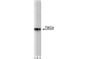 Western Blotting (WB) image for anti-A Kinase (PRKA) Anchor Protein 5 (AKAP5) (AA 180-427) antibody (ABIN967900) (AKAP5 anticorps  (AA 180-427))