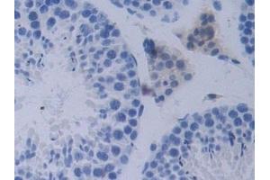 Detection of PCSK1 in Mouse Testis Tissue using Polyclonal Antibody to Proprotein Convertase Subtilisin/Kexin Type 1 (PCSK1)