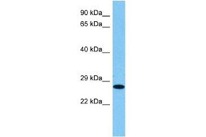 Host:  Rat  Target Name:  HMGB1  Sample Tissue:  Rat Skeletal Muscle  Antibody Dilution:  1ug/ml (HMGB1 anticorps  (N-Term))