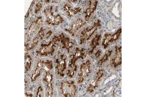 Immunohistochemical staining of human kidney with SUSD2 polyclonal antibody  show strong cytoplasmic and membranous positivity in cells in tubules at 1:200-1:500 dilution. (SUSD2 anticorps)