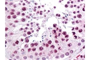 Immunohistochemistry (IHC) image for anti-Sirtuin 1 (SIRT1) (AA 456-555) antibody (ABIN614713)