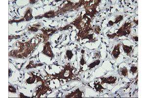 Image no. 2 for anti-butyrobetaine (Gamma), 2-Oxoglutarate Dioxygenase (Gamma-butyrobetaine Hydroxylase) 1 (BBOX1) antibody (ABIN1496819)