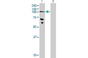 Western Blot analysis of HK3 expression in transfected 293T cell line by HK3 MaxPab polyclonal antibody. (HK3 anticorps  (AA 1-923))