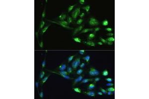 Immunofluorescence analysis of U2OS cells using VIM antibody.