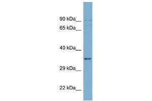 WB Suggested Anti-UBXN1  Antibody Titration: 0. (UBXN1 anticorps  (Middle Region))