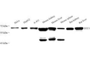 Western blot analysis of IFIT3 (ABIN7074333),at dilution of 1: 2000 (IFIT3 anticorps)