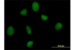 Immunofluorescence of purified MaxPab antibody to ORC3L on HeLa cell. (ORC3 anticorps  (AA 1-712))