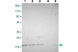 Western blot analysis of lane 1: RT-4, lane 2: U-251 MG, lane 3: A-431, lane 4: Liver and lane 5: Tonsil using SUB1 polyclonal antibody . (SUB1 anticorps)