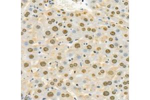 Immunohistochemistry of paraffin embedded mouse liver using Adenosine kinase (ABIN7072953) at dilution of 1: 300 (400x lens)