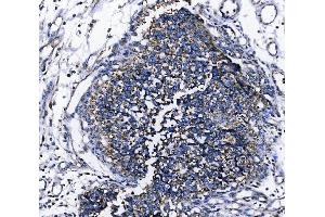 IHC analysis of TOMM70 using anti-TOMM70 antibody (ABIN7599855). (TOM70 anticorps  (AA 122-608))