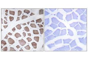 Immunohistochemistry (IHC) image for anti-Mitochondrial Ribosomal Protein S18C (MRPS18C) (Internal Region) antibody (ABIN1850530) (MRPS18C anticorps  (Internal Region))