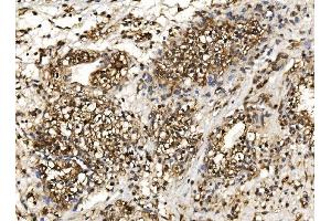 IHC analysis of Proteasome 20S Beta 7/PSMB7 using anti-Proteasome 20S Beta 7/PSMB7 antibody (ABIN7600256).