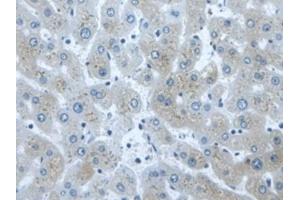 Detection of DVL1 in Human Liver Tissue using Polyclonal Antibody to Dishevelled, Dsh Homolog 1 (DVL1)