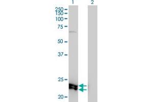 Western Blot analysis of DSU expression in transfected 293T cell line by DSU monoclonal antibody (M01), clone 8F9-1B2.