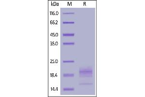 Biotinylated Human CD52, His,Avitag on  under reducing (R) condition. (CD52 Protein (CD52) (AA 25-36) (His tag,AVI tag,Biotin))