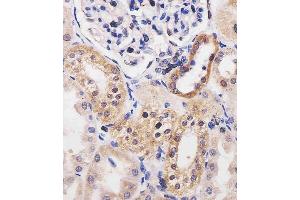 (ABIN6242147 and ABIN6577254) staining ADK in human kidney tissue sections by Immunohistochemistry (IHC-P - paraformaldehyde-fixed, paraffin-embedded sections).