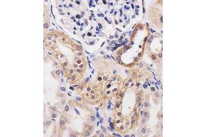 (ABIN6242147 and ABIN6577254) staining ADK in human kidney tissue sections by Immunohistochemistry (IHC-P - paraformaldehyde-fixed, paraffin-embedded sections). (ADK anticorps  (AA 1-345))