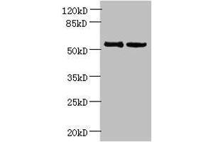 Western blot All lanes: UTP15 antibody at 5 μg/mL Lane 1: Hela whole cell lysate Lane 2: HepG2 whole cell lysate Secondary Goat polyclonal to rabbit IgG at 1/10000 dilution Predicted band size: 59, 37, 57 kDa Observed band size: 59 kDa (UTP15 anticorps  (AA 234-518))
