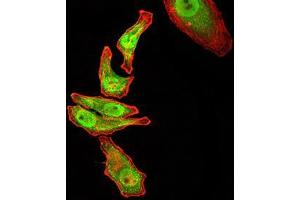 Immunofluorescence analysis of GC-7901 cells using RAN mouse mAb (green).