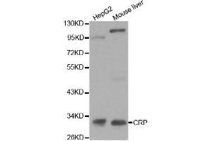 Western Blotting (WB) image for anti-C-Reactive Protein (CRP) (AA 1-224) antibody (ABIN3020716) (CRP anticorps  (AA 1-224))
