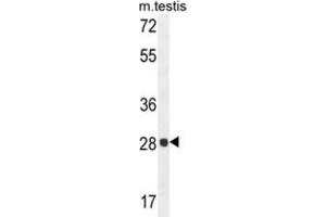 Western Blotting (WB) image for anti-phosphoglycerate Mutase 2 (Muscle) (PGAM2) antibody (ABIN2995678)