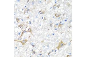 Immunohistochemistry of paraffin-embedded rat brain using IL22 antibody (ABIN5975407) at dilution of 1/100 (40x lens). (IL-22 anticorps)