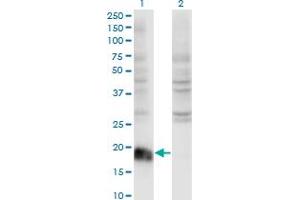 Western Blot analysis of ARF6 expression in transfected 293T cell line by ARF6 monoclonal antibody (M01A), clone 2A4. (ARF6 anticorps  (AA 1-175))