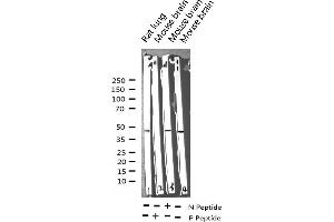 Western blot analysis of Phospho-MEK1/2 (Ser217) expression in various lysates