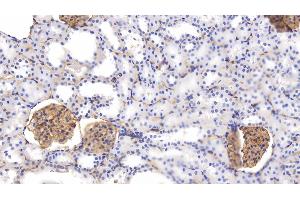 Detection of PODXL in Rat Kidney Tissue using Polyclonal Antibody to Podocalyxin (PODXL)