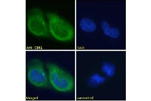 ABIN184784 Immunofluorescence analysis of paraformaldehyde fixed U251 cells, permeabilized with 0.