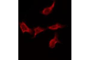 ABIN6275577 staining Hela by IF/ICC. (SCN4A anticorps  (Internal Region))