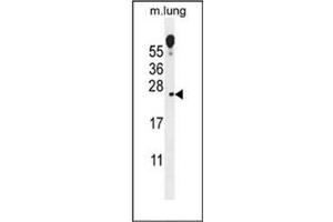 Western blot analysis of VOPP1 Antibody (Center) in mouse lung tissue lysates (35ug/lane).