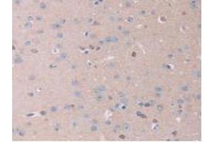 IHC-P analysis of Mouse Brain Tissue, with DAB staining. (IL13RA2 anticorps  (AA 228-338))