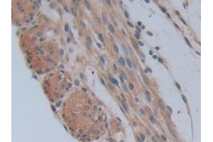 Detection of PFKP in Mouse Uterus Tissue using Polyclonal Antibody to Phosphofructokinase, Platelet (PFKP)