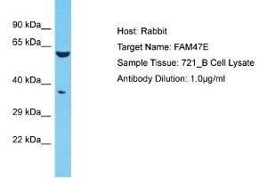 Host: Rabbit Target Name: FAM47E Sample Type: 721_B Whole Cell lysates Antibody Dilution: 1. (FAM47E anticorps  (C-Term))