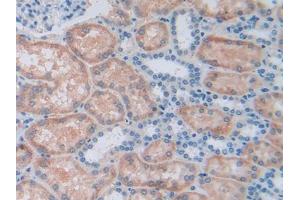 DAB staining on IHC-P; Samples: Human Kidney Tissue